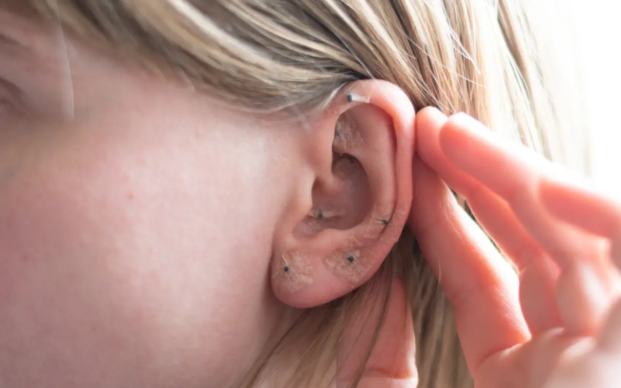 La auriculoterapia es útil para fisioterapeutas.